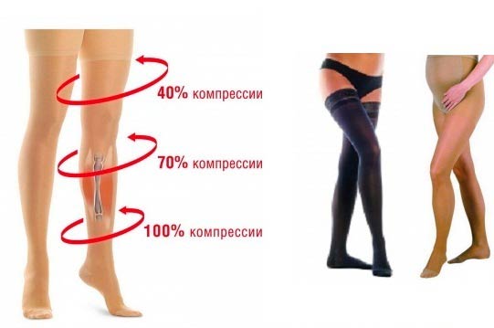 Воздействие компрессионного трикотажа