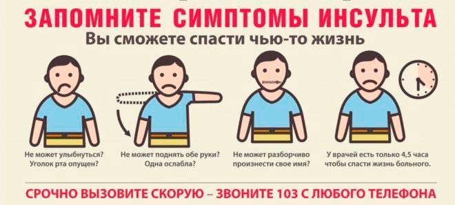Признаки инсульта