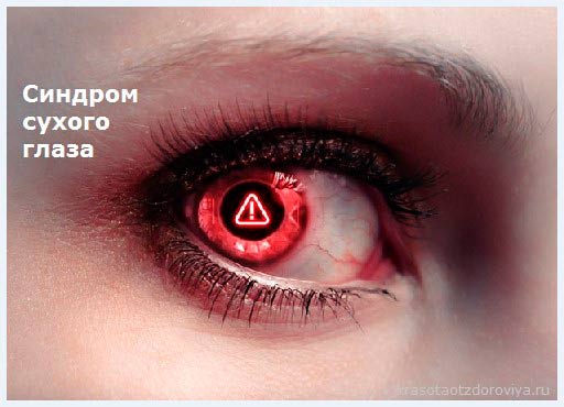Сухость глаз